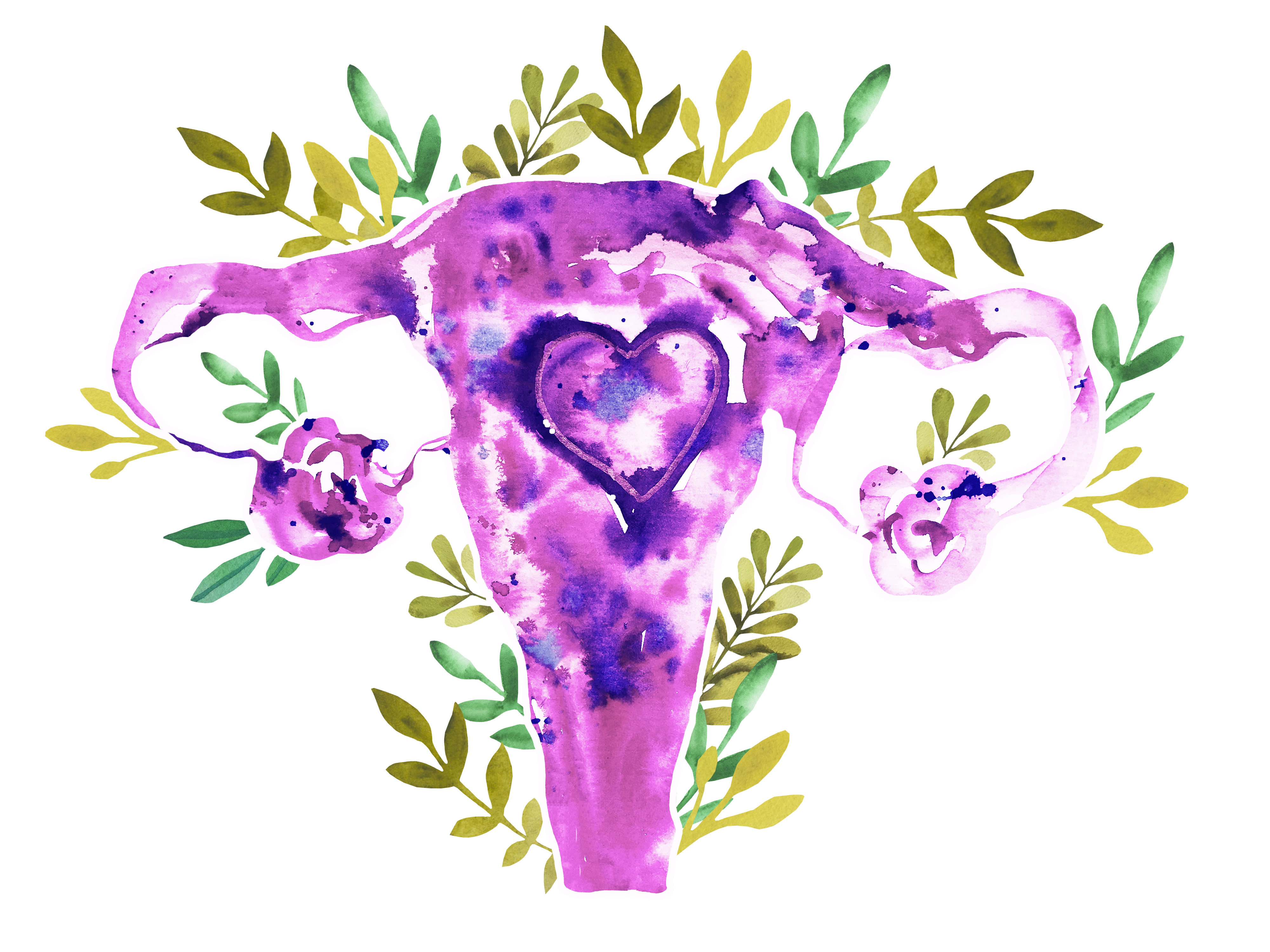 #415 Endometriosis